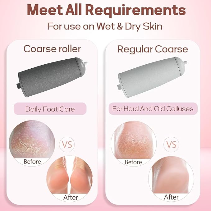 Flewless Callus Remover - Pedicure Tool